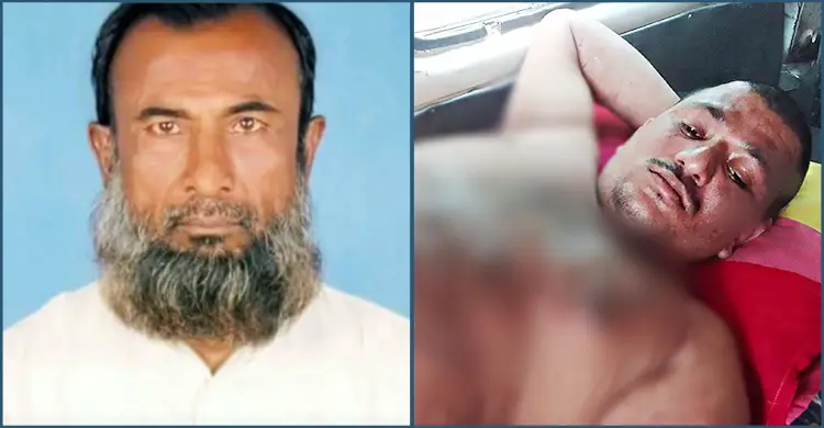 পাঞ্জাবি টেনে ধরায় প্রতিবন্ধীর শরীরে গরম পানি ঢেলে দিলেন আ’লীগ নেতা